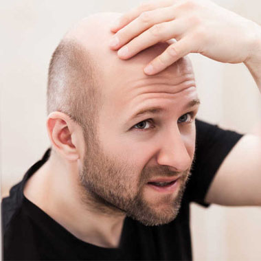 a man with out hair